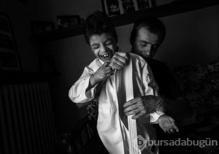 Şimdiye kadar 9 kişide görüldü!	
