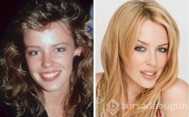 &#8203;20 pop yıldızının ünlü olmadan önce çekilmiş fotoğrafları
