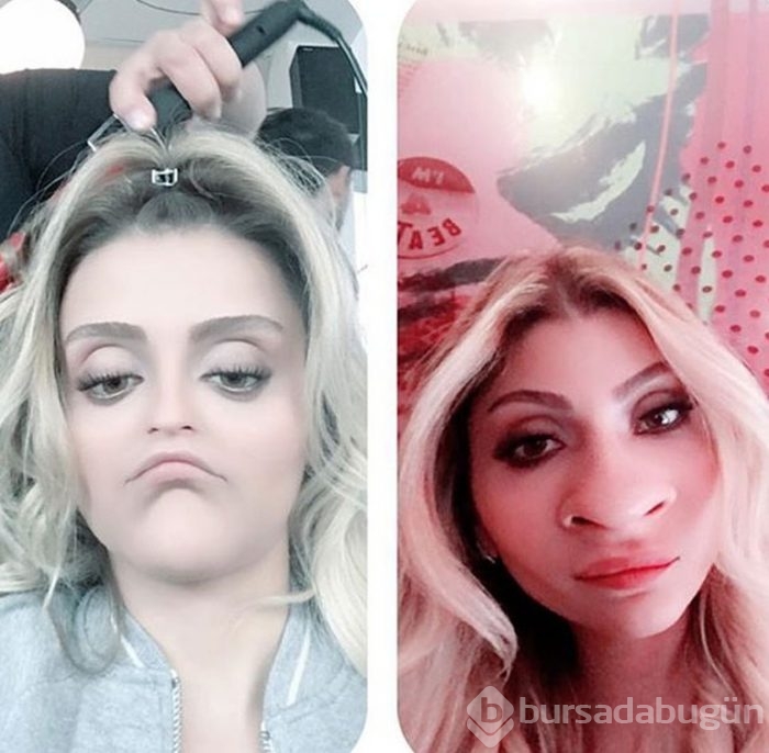 Özge Ulusoy yüzünü değiştirdi