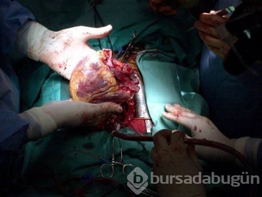 Kök hücreden gerçek boyutlarda atabilen kalp ürettiler