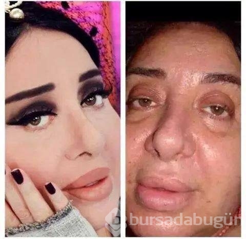 Nur Yerlitaş: Meme estetiği düşünüyorum
