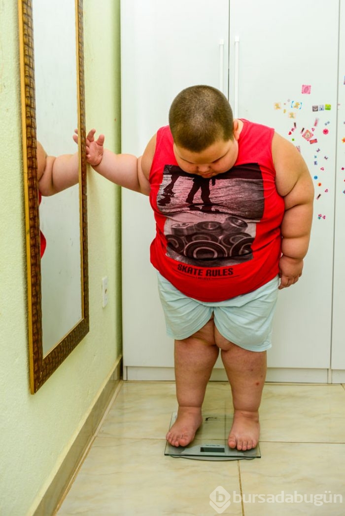 5 yaşında 80 kilo