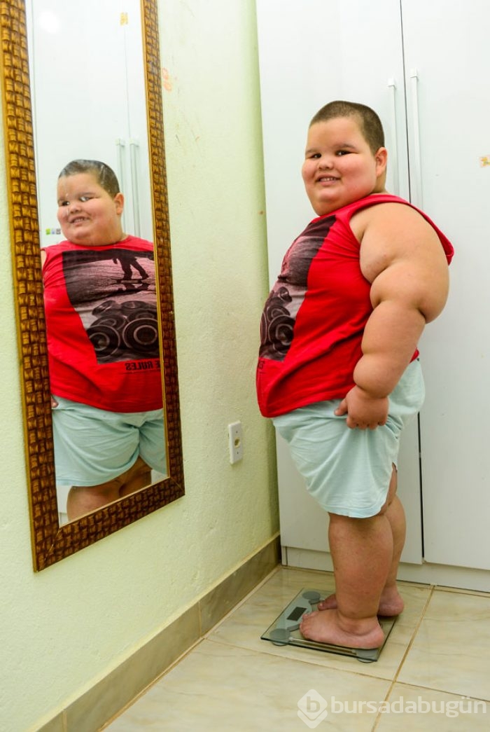 5 yaşında 80 kilo