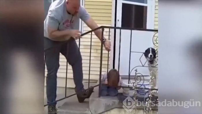 Kafası sıkışan çocuk kendini mucizevi bir yöntemle kurtardı