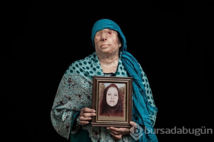 Asit kurbanları