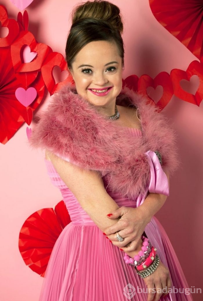 Dünyanın ilk Down sendromlu modeli Katie Meade
