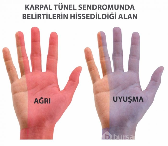 Parmağın dokusunu bozuyor