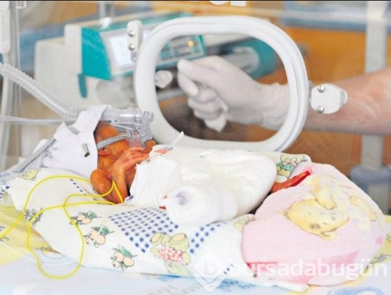 Polonya'da mucize bebek