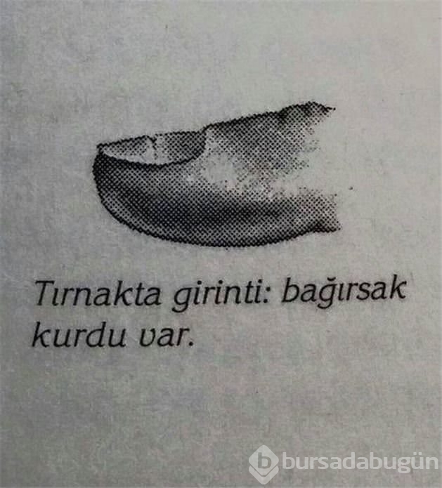 Tırnak şekliniz sağlığınızı ele veriyor!