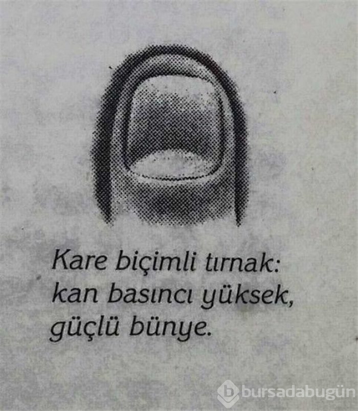 Tırnak şekliniz sağlığınızı ele veriyor!