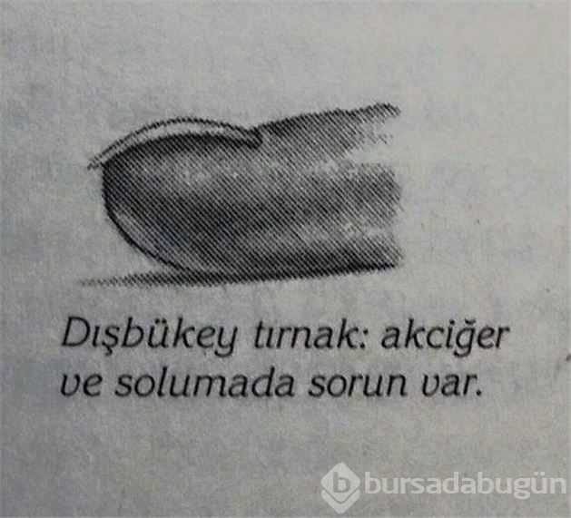 Tırnak şekliniz sağlığınızı ele veriyor!