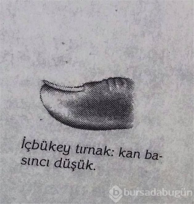 Tırnak şekliniz sağlığınızı ele veriyor!
