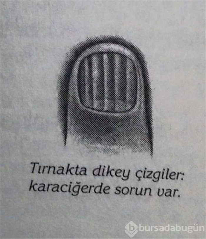 Tırnak şekliniz sağlığınızı ele veriyor!