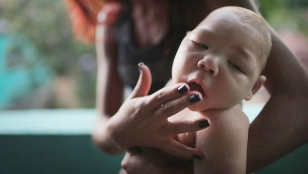 Zika virüsü nedir? Nasıl yayılır?