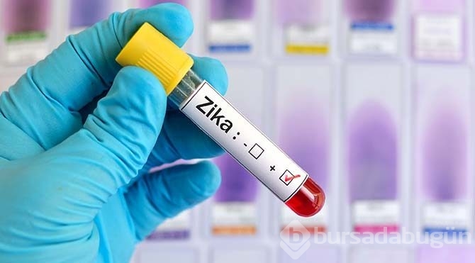 Zika virüsü nedir? Nasıl yayılır?