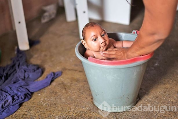 Zika virüsü nedir? Nasıl yayılır?
