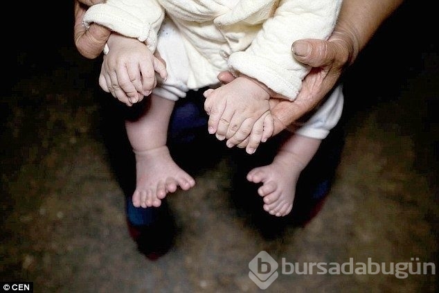 Bu bebeğin tam 31 parmağı var!