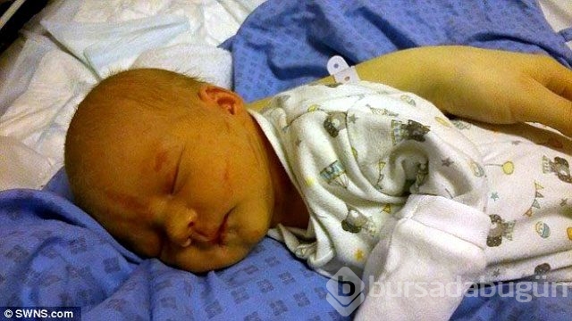 Sezaryen sonrası olabilecek en kötü şey!
