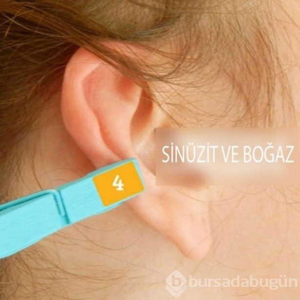 Kulağı mandala sıkıştırmak acı dindirir mi?