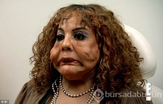 Sahte doktor faciası! Bakın yüzüne ne enjekte etmişler...
