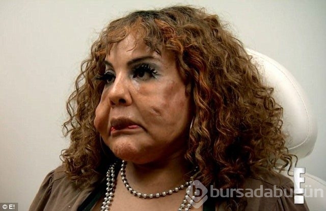 Sahte doktor faciası! Bakın yüzüne ne enjekte etmişler...
