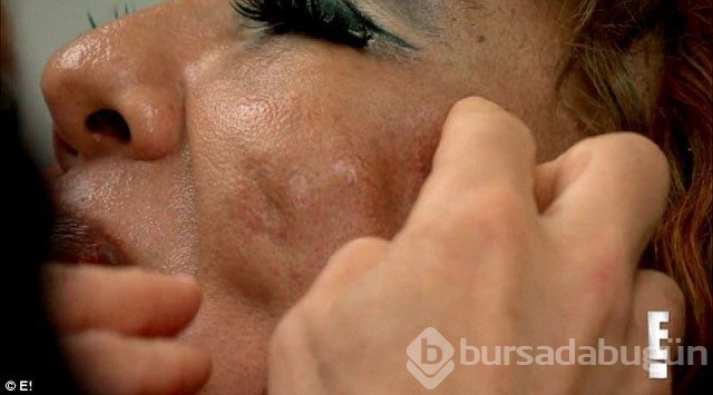Sahte doktor faciası! Bakın yüzüne ne enjekte etmişler...
