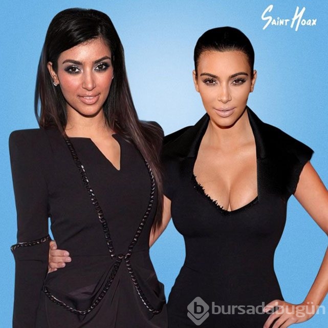 Kardashian'ların estetiksiz halleri
