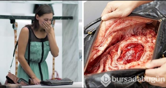 Çantayı açınca dehşete düştü