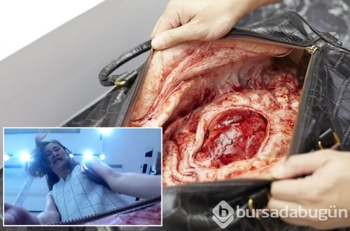 Çantayı açınca dehşete düştü