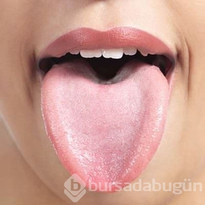 Diline bak hastalığını öğren
