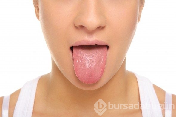 Diline bak hastalığını öğren