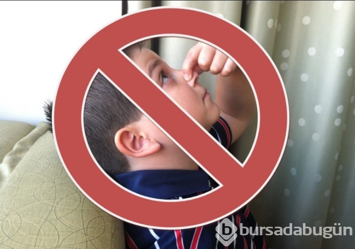 Yanık bölgeye yoğurt sürerseniz
