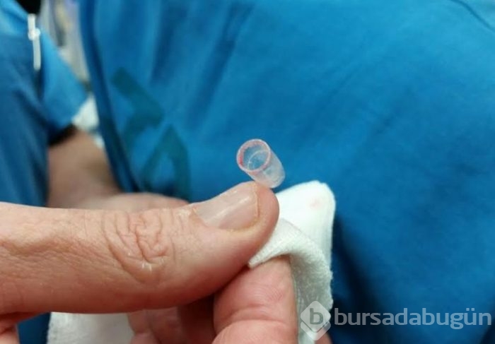 Tükenmez kalemlerin kapaklarındaki deliğin ne işe yaradığına inanamayacaksınız