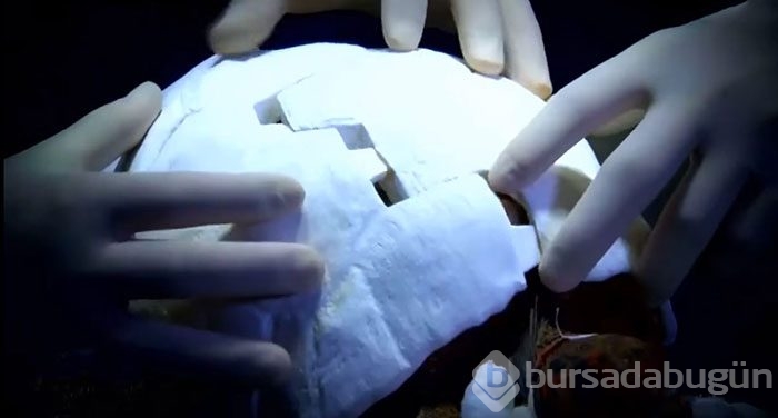 3D lazer teknolojisiyle bir ilk: Kaplumbağa kabuğu
