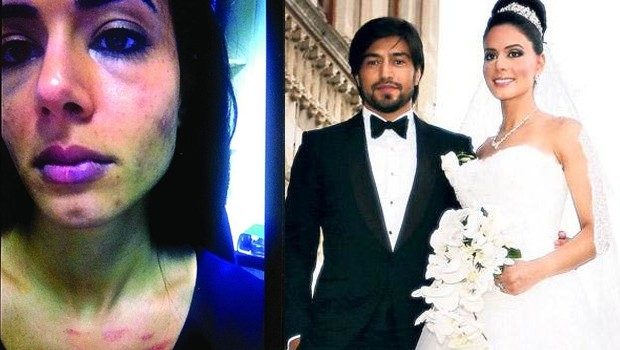 ''Kucağımda çocuk olmasına rağmen yüzüme yumrukla vurdu''
