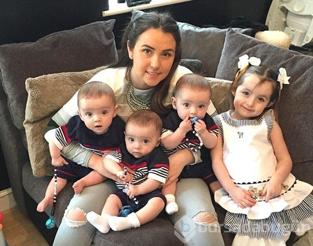 Bu bebekler 200 milyonda bir görülen bir özelliğe sahip
