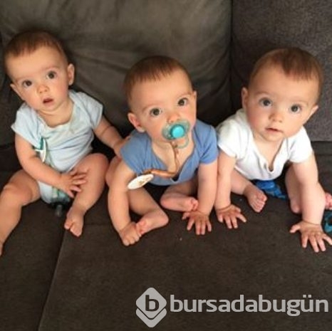 Bu bebekler 200 milyonda bir görülen bir özelliğe sahip