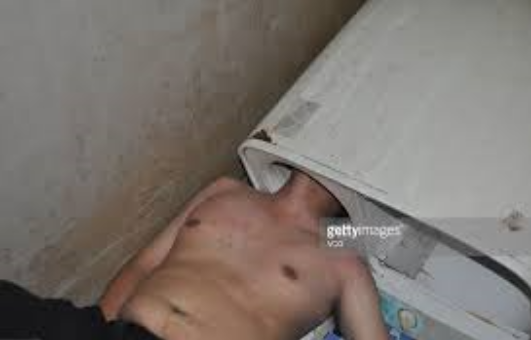 Kafasını öyle bir yere sıkıştırdı ki...