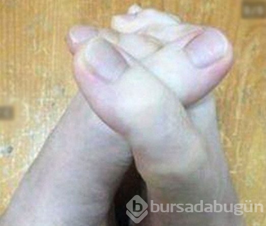 Ayak parmaklarının uzunluğu şaşırttı
