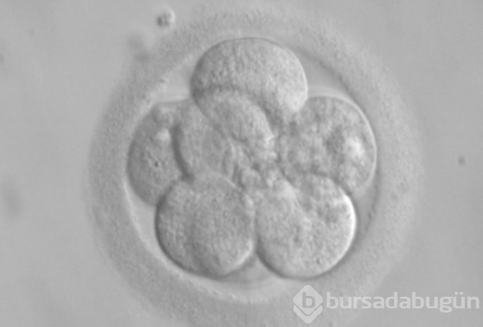 Domuz vücudunda insan organı yetiştirilecek
