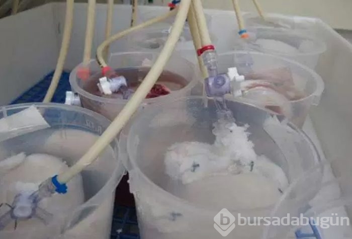 Domuz vücudunda insan organı yetiştirilecek