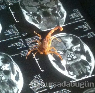 İnsan neslini akrep ve örümcek zehiri kurtaracak