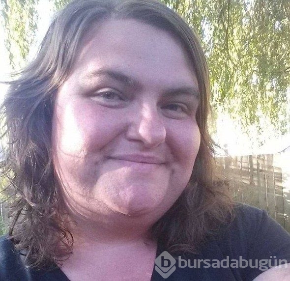13 yaşından beri sakalları çıkıyor, daha kadınsı ve seksi hissediyor
