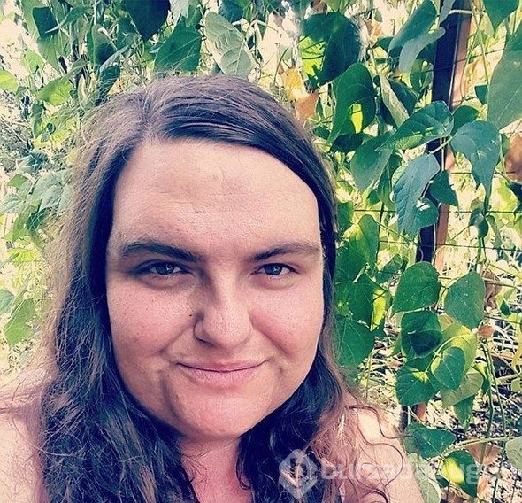 13 yaşından beri sakalları çıkıyor, daha kadınsı ve seksi hissediyor