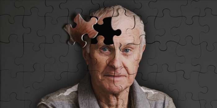 Alzheimer teşhisinde 10 yıllık avantaj