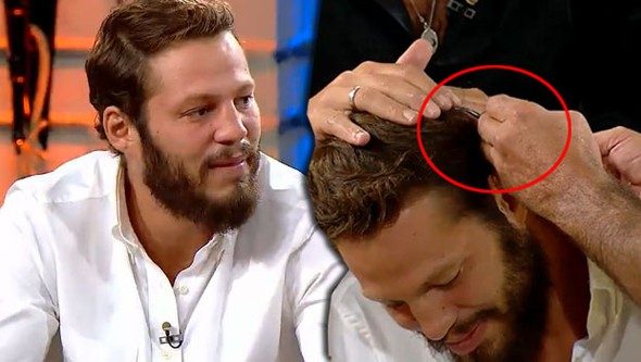 Survivor Atakan'ın canlı yayında dikişlerini aldılar