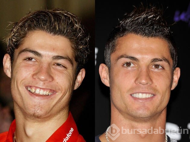 Cristiano Ronaldo'nun estetik ameliyatları