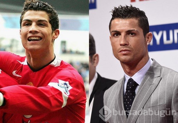 Cristiano Ronaldo'nun estetik ameliyatları