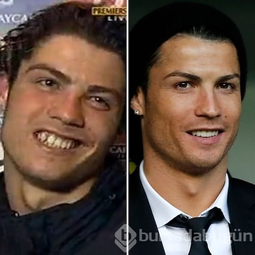 Cristiano Ronaldo'nun estetik ameliyatları