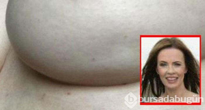 O belirtiyi fark etti, hayatı kurtuldu